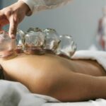 12 Signs That Cupping Therapy in Edmonton Could Benefit You