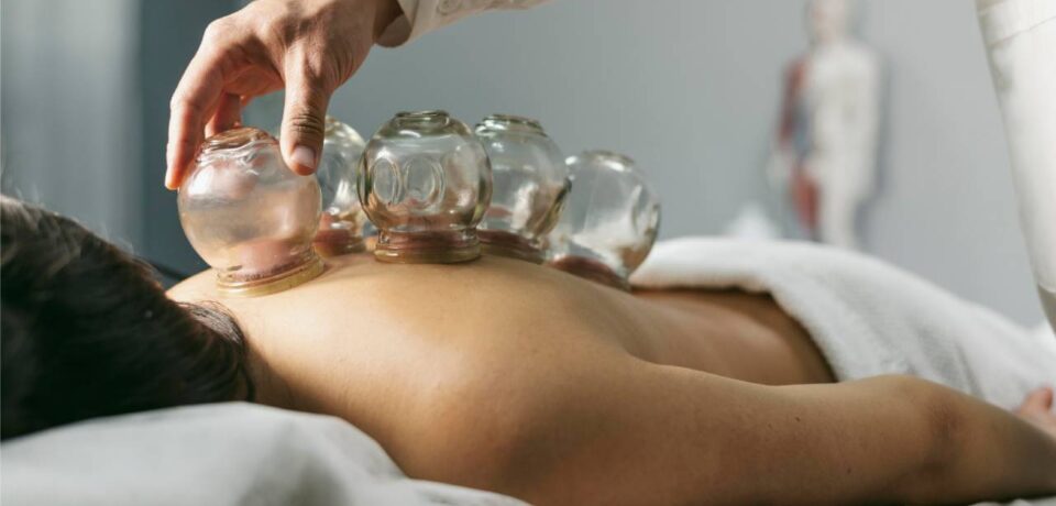 Cupping Therapy
