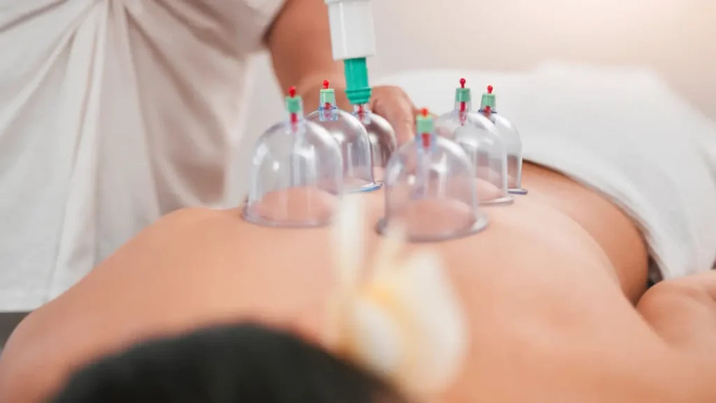 7 Signs Cupping Therapy May Support Muscle Recovery